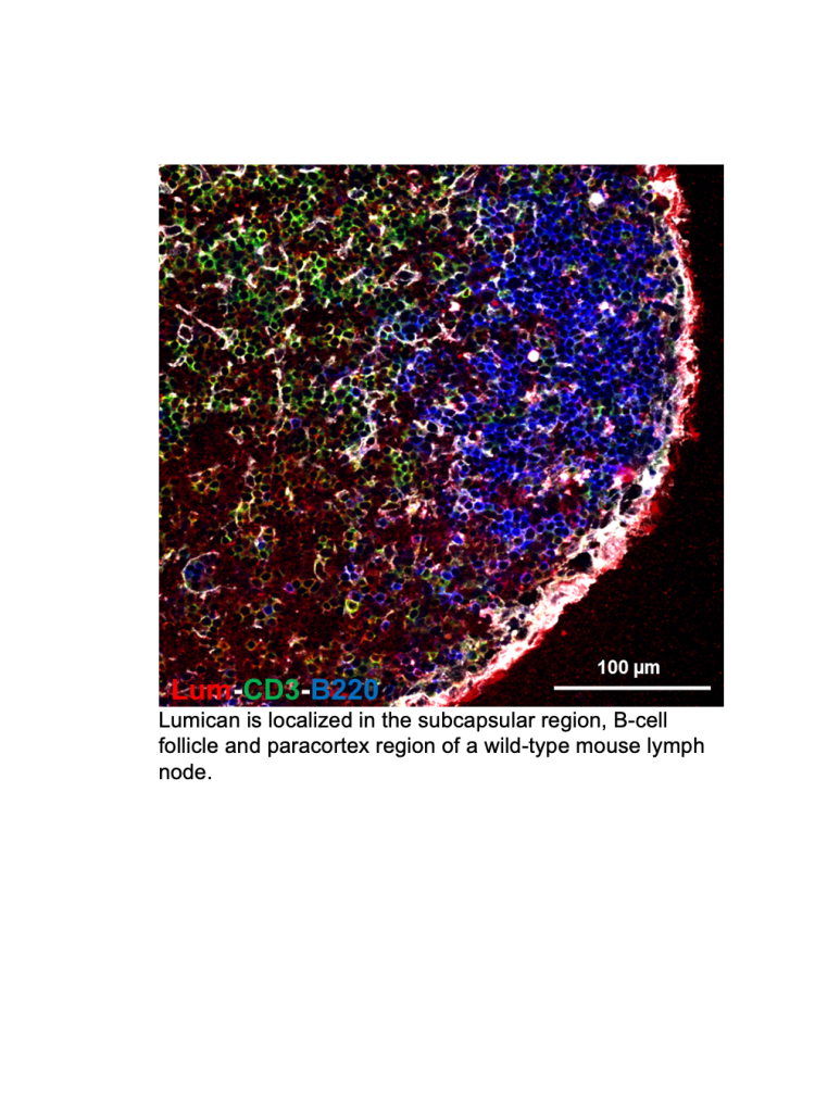 Emerging role of ECM components in immune response and inflammation