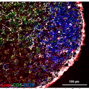 Emerging role of ECM components in immune response and inflammation