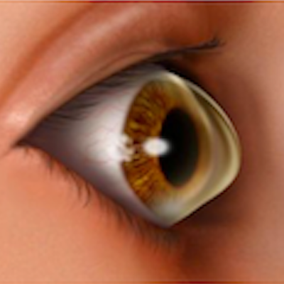 Understanding keratoconus, a cell and ECM degenerative corneal disease